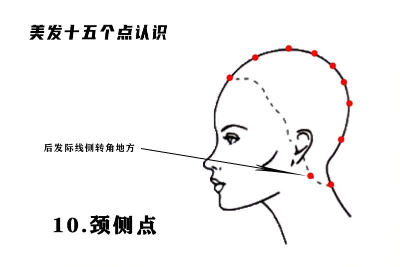颈侧点.png